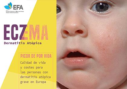 Dermatitis Atópica