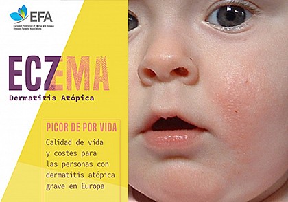 Informe Dermatitis atópica